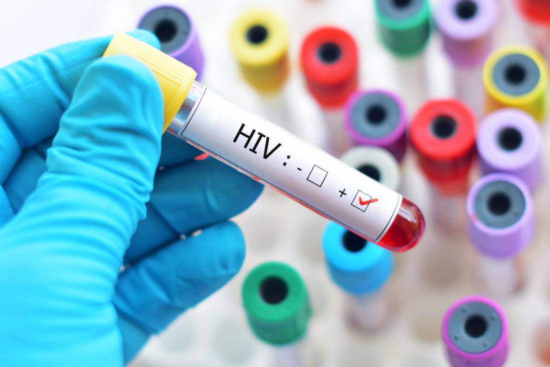 hiv malattie sessualmente trasmissibili 