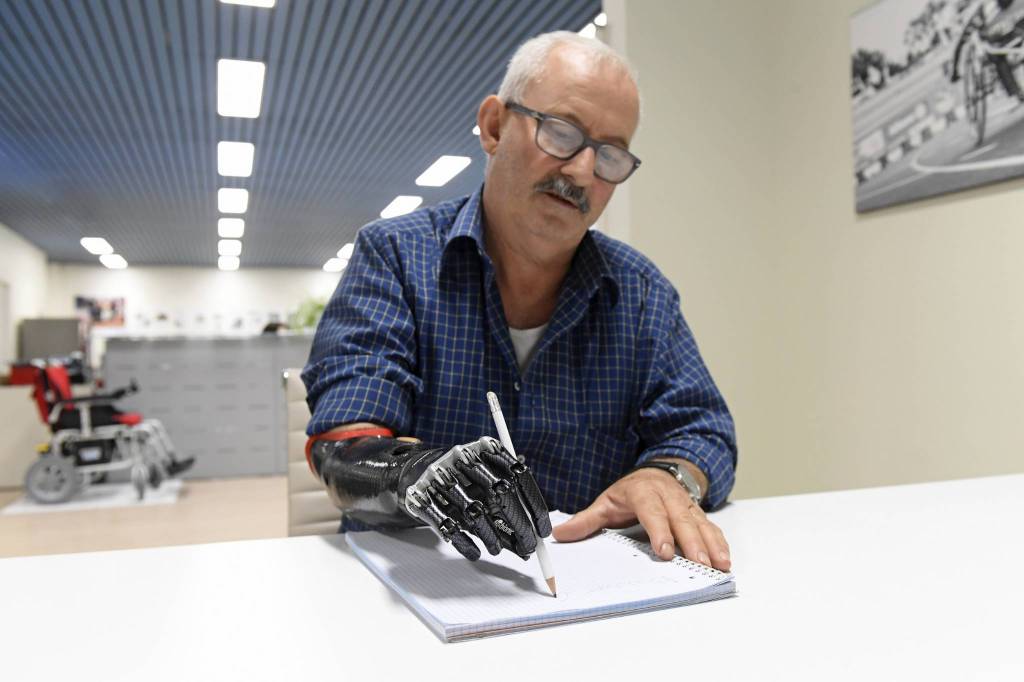 Applicata una mano “bionica” ad un artigiano di Mondovì